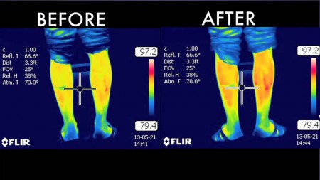 Effetto prima e dopo l'applicazione del cerotto